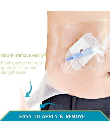 Waterproof Adhesive Bandage Peritoneal Dialysis Catheter Cover 6x197 Inch - Pack of 1 - Buy Online on GoSupps.com