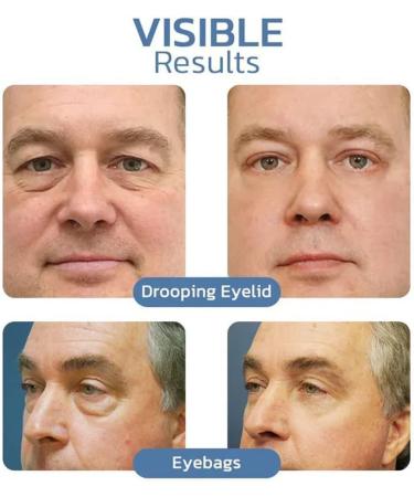 Peptide Eye Gels Set Awaken Peptide Lifting Eye Gel Rejuvenating Eye Lifting Gel for Men and Women Anti-Aging Eye Serum for Men Men's Anti-Aging Serum for Firming(2 set) - Buy Online on GoSupps.com