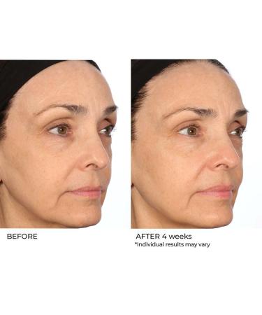 NassifMD Pro Peptide Collagen Serum | Anti-Aging Treatment for Fine Lines Wrinkles & Textured Skin - Firm & Smooth Your Skin - Buy Online on GoSupps.com