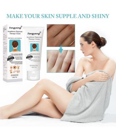 Fengyang Acanthosis Nigricans Cream Anti-Dark Spots Cream Correcting Cream for Elbow Knee Joint - Buy Online on GoSupps.com
