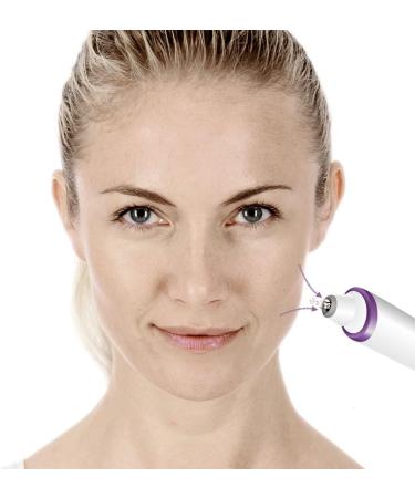 Beurer FC 76 Microdermabrasion Device - Improve Complexion & Refine Pores | Lightweight Handheld Skin Care Tool - Buy Online on GoSupps.com
