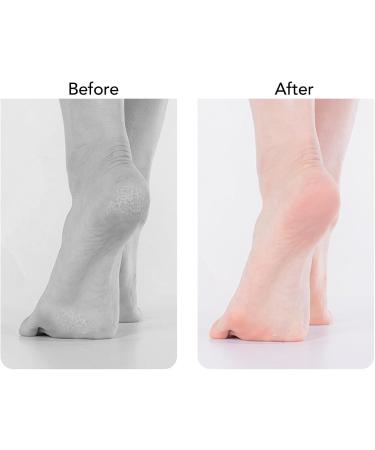 Rechargeable Electric Foot Callus Remover Foot File Foot Scrubber with 2 Speeds 2 Abrasive Heads Dust Suction Long Lasting Battery for Salon-like Foot Care - Buy Online on GoSupps.com