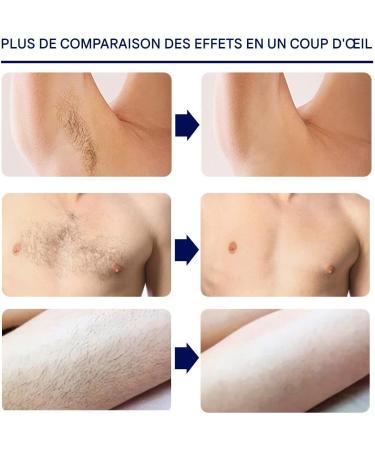 Depilatory Body Cream - 60 ml Effective Painless Soothing Depilatory Gel Hair Removal for Sensitive Skin Types Arms Legs Back Torso Intimate Area - Buy Online on GoSupps.com