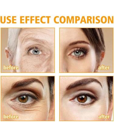 Cr me contour des yeux Cr me r paratrice anti- ge aux peptides 5D anti-rides liftante et raffermissante r duit les poches et les cernes pour tous types de peau 1pcs - Buy Online on GoSupps.com