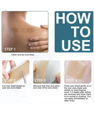 Silicone Scar Sheets Roll 1.6 x 40 | Professional Scar Removal Tape for C-Section Surgery Keloid Acne - Reusable & Effective Silicone Strips - Buy Online on GoSupps.com