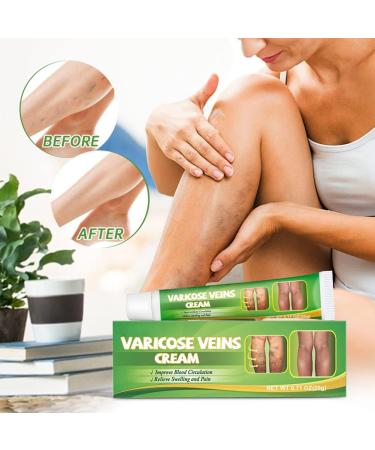  Katutude Repair cream for varicose veins and spider veins. Varicose vein cream to relieve varicose veins and spider veins. - Buy Online on GoSupps.com