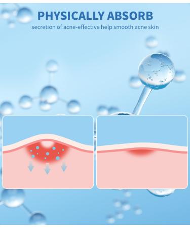 Buy Pimple Patches for Face - Hydrocolloid Acne Strips with Salicylic Acid & Tea Tree Oil - Effective Blemish & Pore Cleansing for All Skin Types - Buy Online on GoSupps.com