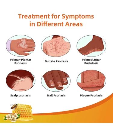 HEKEWER Bee Venom Psoriasis Treatment Cream Set - Soothing Relief for All Skin Types - Buy Online on GoSupps.com