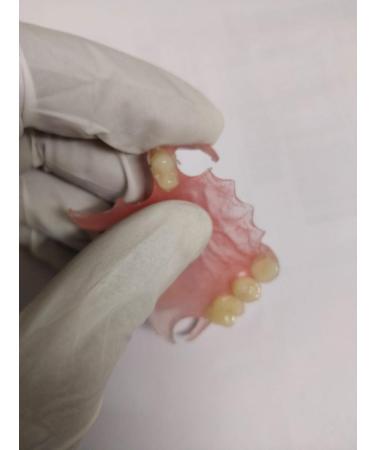 Custom Pink Valplast Partial Denture - Affordable & Flexible - Buy Online on GoSupps.com