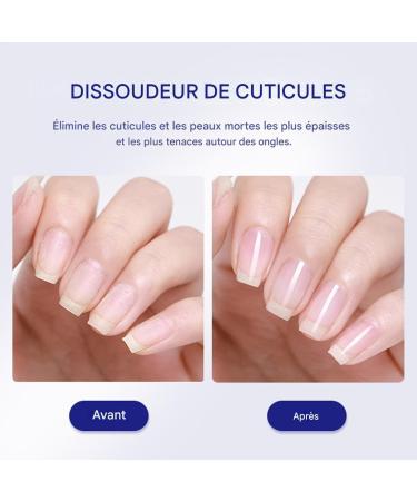Cuticle Soother Repairing Pedicure Products | 30ml Moisturizing Cuticle Soother Gel - for Dead Skin Damaged Nails Foot and Hand Care Daily Beauty Routine Salon and Home - Buy Online on GoSupps.com