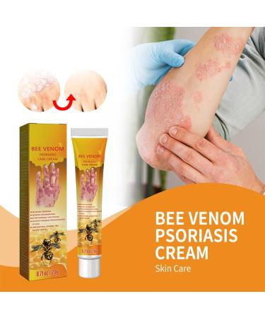 KCRPM Youth Bee Venom Psoriasis Treatment Cream - Soothing & Moisturizing Formula for All Skin Types | 1pcs - Buy Online on GoSupps.com