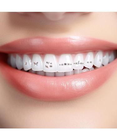 Yiurse Toothstones Reflective Crystal Set - DIY Dental Jewelry & Tartar Remover - Fashionable Professional Teeth Care - Buy Online on GoSupps.com