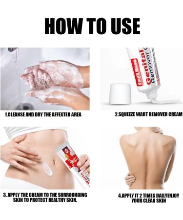 Fast Acting Cream Wart Remover - Maximum Strength Relief for Plantar Genital Common & Flat Warts - International Shipping Available - Buy Online on GoSupps.com