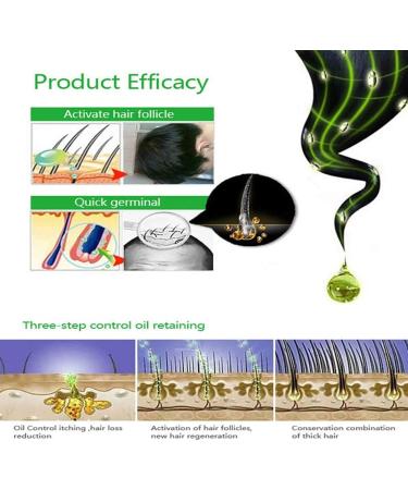 Lucoss Anti-Hair Loss Shampoo Improve Hair Quality Natural Herbal Extract Shampoo Best Hair Growth Shampoo Stimulates Hair Growth Helps Stop Hair Loss Grow Hair Fast Hair Loss Treatment. - Buy Online on GoSupps.com