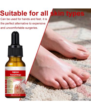 XPEX 30ml Mycose Ongles Des Pieds Strengthens and Revitalizes Nails pour Nails Damaged by Mycosis or Light Trauma pour D color s Endommag s et pais - Buy Online on GoSupps.com