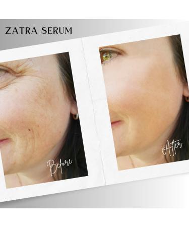 Snail Mucin Serum 96% - Hydrating Anti-Aging Treatment for Dull Skin & Fine Lines - 100ml - Buy Online on GoSupps.com