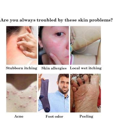 JIULIN 3pcs/Lot Chinese Herbal Eczema Psoriasis Creams - Effective Relief for Dermatitis, Pruritus, and Psoriasis - Buy Online on GoSupps.com