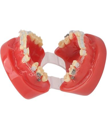 Buy Ververt Touch Ceramic Dental Orthodontic Bracket Model - 24 Teeth Demo Model for Teacher Training | International Shipping Available - Buy Online on GoSupps.com