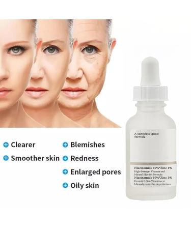Niacinamide Serum for Face - 10% Niacinamide + 1% Zinc | Best Acne Treatment - 30ML - Buy Online on GoSupps.com