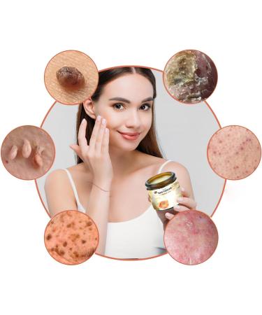 LXCJZY Bee Venom Cream Professional Bee Venom Repair Cream Professional Bee Venom Correcting Gel Bee Venom Mole and Wart Treatment Cream for All Parts of The Body (3pcs) - Buy Online on GoSupps.com