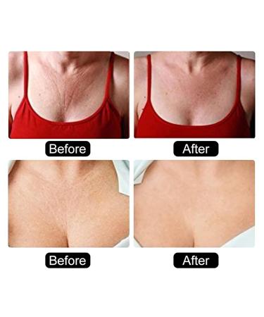 Ymiko Anti-Wrinkle Chest Pads | Reusable Silicone Decollete Bra Care | Invisible Heart Shape for Smooth Skin - Buy Online on GoSupps.com