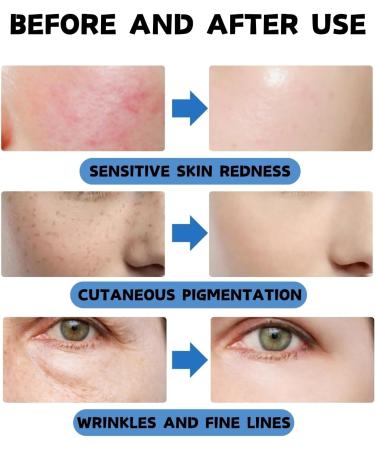 Dark Spot Correcting Glow Serum - 5% Vitamin B5 & Hyaluronic Acid Serum - Hyaluronic Acid Serum for Face - Hydrating Anti-Aging Face Serum for Women - Improving Skincare Nicotinamide Serum - Buy Online on GoSupps.com