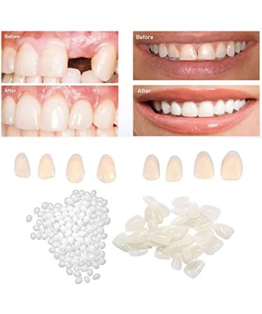 PNEGXIN Fake Teeth Repair Kit - Temporary Fix for Missing & Broken Teeth - Buy Online on GoSupps.com