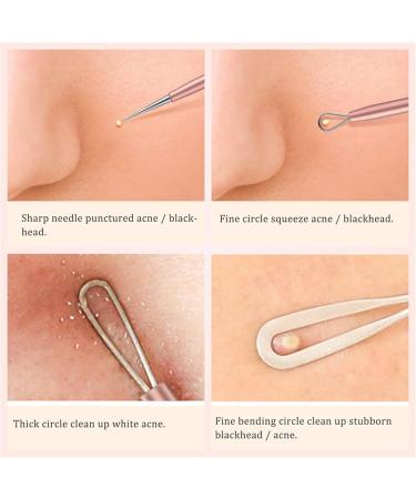Acne Needle 5Pcs Acne Needle Pimple Tweezers Extractor Blackhead Remover Comedone Extractor Tool Blackheads Treatment (Color : 5pcs Gold) - Buy Online on GoSupps.com