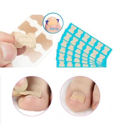 Toenail Patch Ingrown Toenail Toenail Correction Toenail Correction Patch Toenail Correction Patch Ingrown Toenail Nail Care 50 Pieces - Buy Online on GoSupps.com