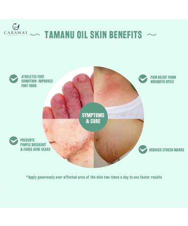 CARAWAY Organic Tamanu Oil - Cold Pressed Natural Moisturizer for Skin Hair & Face - Treats Hyperpigmentation Acne Scars Eczema & Psoriasis - 1.7 Fl oz (50 ml - Buy Online on GoSupps.com
