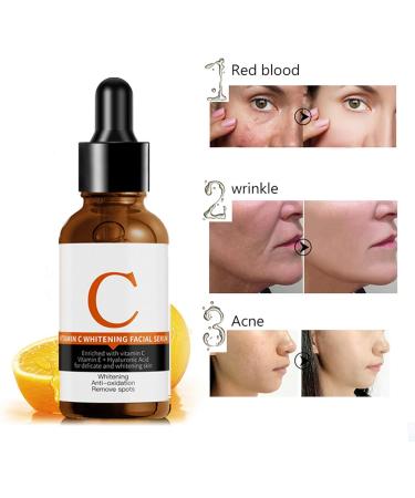 Vitamin C Serum for Face Dark Spot Correcting Glow Serum Anti Aging & Anti Wrinkle Serum Vitamin C Face Serum for Women Plump Hydrate & Brighten - Buy Online on GoSupps.com