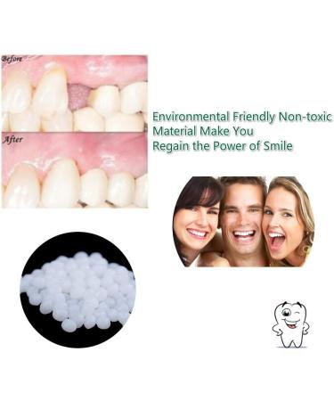 Tooth Repair Kit - Instant Temporary Teeth Replacement for Damaged & Missing Teeth | Best Dental Fix Solution - Buy Online on GoSupps.com