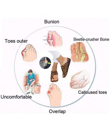 Comfortable Women's Platform Sandals - Orthopedic & Post-Bunion Correction Casual Footwear for Summer | Soft PU Leather Beach Shoes 3 39 EU - Buy Online on GoSupps.com