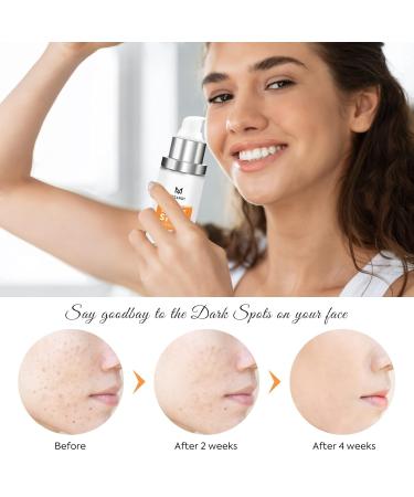 Dark Spot Remover For Face: Dark Spot Corrector Serum for Sun Spots Freckles and Brown Spots with Niacinamide Hyaluronic Acid & Peptides Hydrating Moisturizer for All Skin Types - Buy Online on GoSupps.com