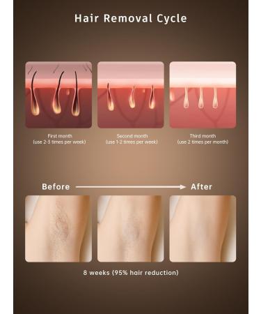 Laser Hair Removal Device for Men & Women - 19.8J IPL Permanent Hair Removal | Fast Flash Technology for Home Use - Buy Online on GoSupps.com