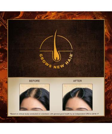 Indulekha Bringha Hair Oil Selfie Bottle 100 ml - Natural Hair Growth Solution | International Shipping Available - Buy Online on GoSupps.com