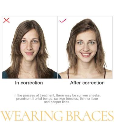 Orthodontic Silicone Chewies for Aligners - Invisalign Chewing Tablets | 2 Pieces Violet Grape for Oral Care & Dental Health - Buy Online on GoSupps.com