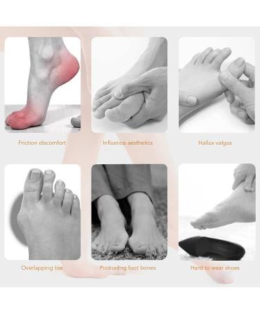 Bunion Separator Sleeve - Flexible & Slip-Preventing Corrector for Toe Valgus (Size L) - Buy Online on GoSupps.com