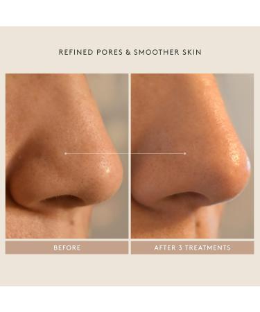 SHANI DARDEN SKINCARE Triple Acid Peel | Mandelic Lactic & Glycolic | Pore Refining & Resurfacing | 1.69 Fl. Oz - Shop Internationally - Buy Online on GoSupps.com