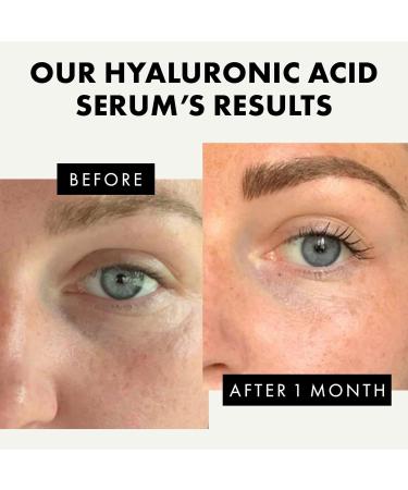 Roxanna 2% Hyaluronic Acid Face Serum 50ml with Vitamin B5 Niacinamde Aloe Vera Plumps Softens & Hydrates Skin Targets Dryness Fine Lines Uneven Skin - Buy Online on GoSupps.com