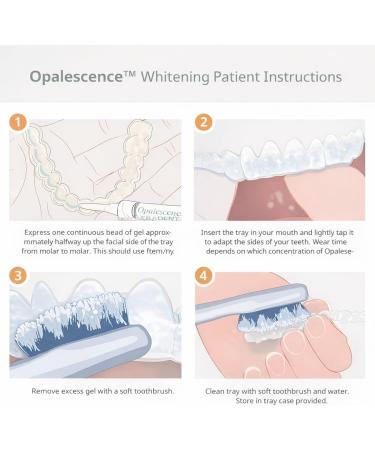 Opalescence 20% with PF Gel Syringes Teeth Whitening (4 Syringes) Refill Kit Carbamide Peroxide. Made by Ultradent in Melon Flavor. Tooth Whitening Refill Syringes 5401-2 1 Count (Pack of 4) Melon 20 - Buy Online on GoSupps.com