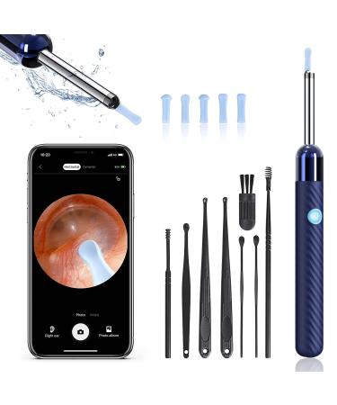 Ear Wax Removal  Ear Cleaner with Camera  Ear Wax Removal Tool Camera with 1080P  Otoscope with Light  Ear Wax Removal Kit with 6 Ear Pick  Ear Camera for iPhone  iPad  Android Phones - Blue