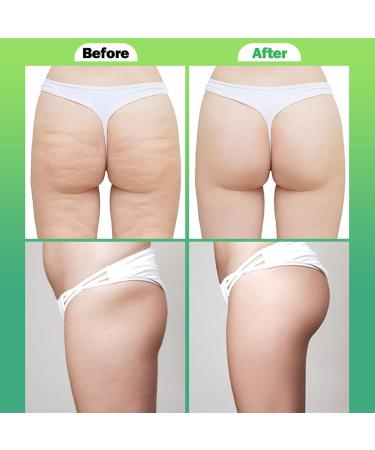 90-Piece Essential Oil Set for Hip Care | Moisturizing Lifting Oil & Solid Massage Serum for Buttocks - Buy Online on GoSupps.com