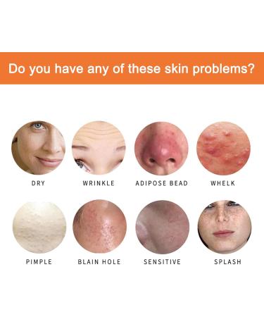 Orgrul Turmeric Kojic-Acid Soap Dark Spot Remover Soap All-Natural Brightening Turmeric Soap Turmeric Face Soap Bar for Deep Cleansing Face Cleanser Bar Soap for Hyperpigmentation & Smooth Skin - Buy Online on GoSupps.com