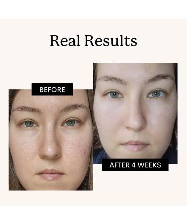 FLEUR & BEE Retinol Moisturizer | Vegan Anti-Aging Cream for All Skin Types | Best Night & Day Retinol Cream | Youth Fairy 1.5 oz - Buy Online on GoSupps.com