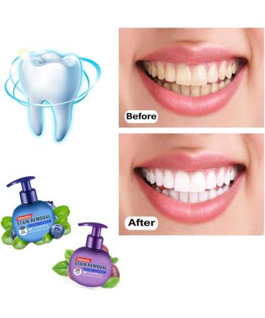 Baking Soda Whitening Toothpaste - Intensive Stain Remover, Strengthening & Fluoride-Free - Passion Fruit Flavor - Buy Online on GoSupps.com