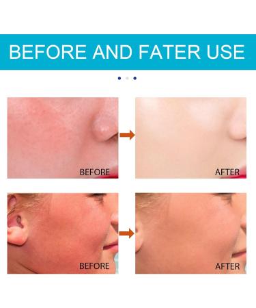 Sunscreen Stick Spf 50 Face Moisturiser - Ultraviolet Protection Centella Sunscreen Spf 50 Face - Moisturising Sun Cream Waterproof Sweatproof - Fresh Not Sticky Sunscreen Stick - Before Makeup - Buy Online on GoSupps.com