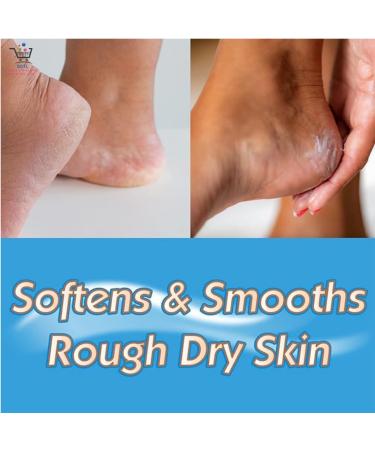 SOTL 2X Masterplast Heel Balm Soften For Relief Comfort Soothing & Healing Cream Dry Cracked Chapped Heels Moisturise 70g - Buy Online on GoSupps.com