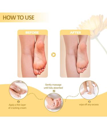 3 Pack Cracked Skin Repair Cream Anti Chapping Cream for Winter Skin Winter Cracked Hand & Foot Cream Dry Foot Ointment Cream Heel Cracks - Buy Online on GoSupps.com