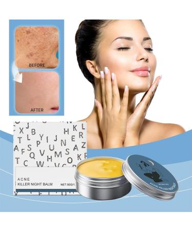 Anti-Acne Skin Care Set for Men Anti-Redness Moisturizes Acne Prone Skin Anti-Acne Skin Care Set Filled with Hand-Picked Organic Botanicals - Buy Online on GoSupps.com